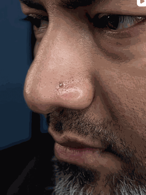 Minimal Nostril Diamond